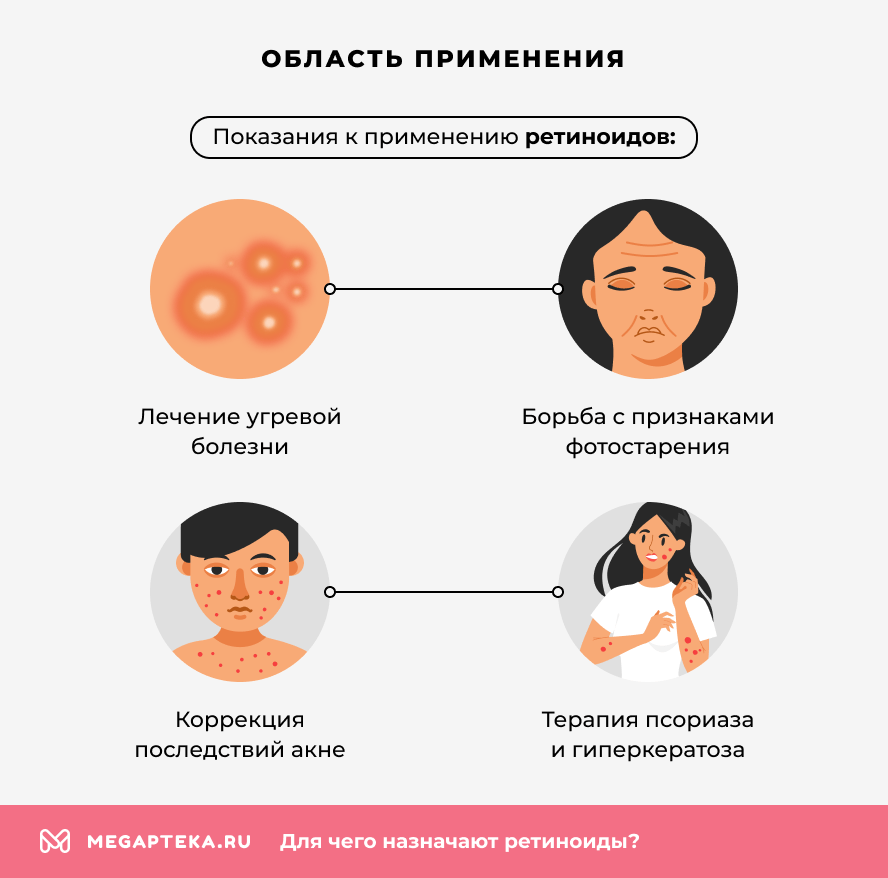 Область применения