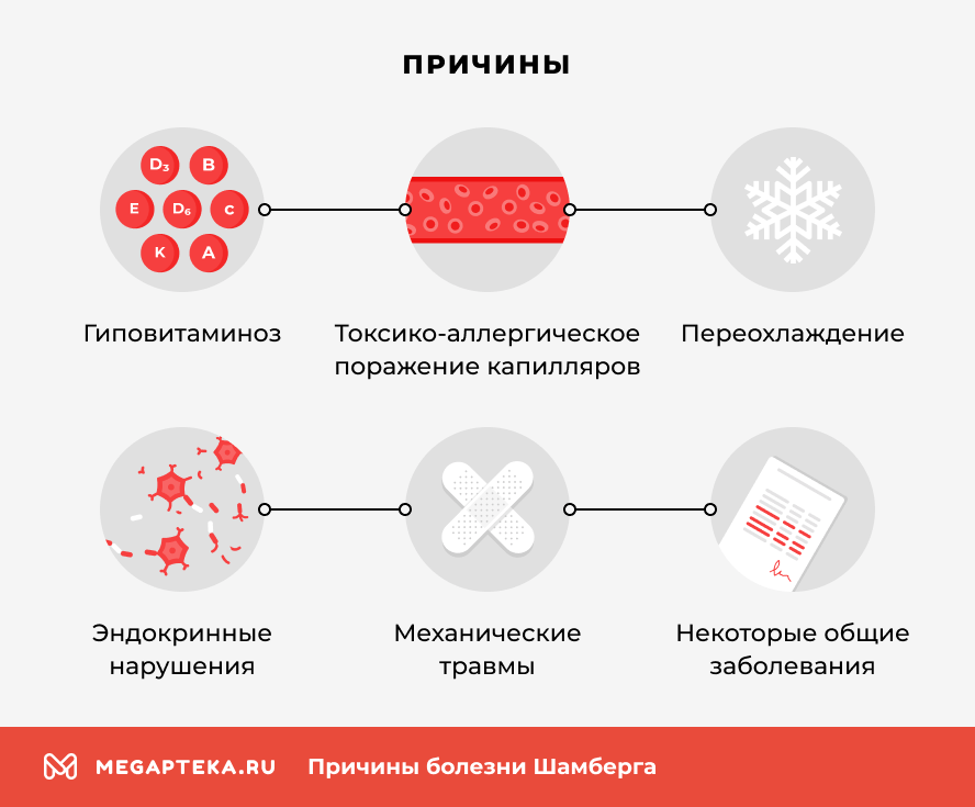 Причины