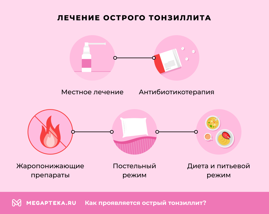 Лечение острого тонзиллита