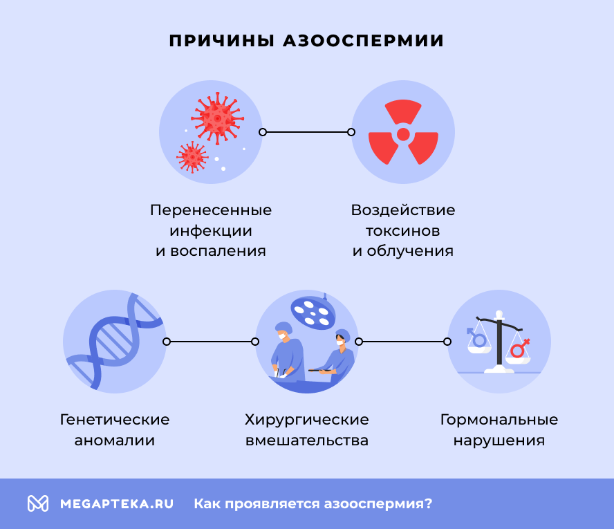 Причины азооспермии