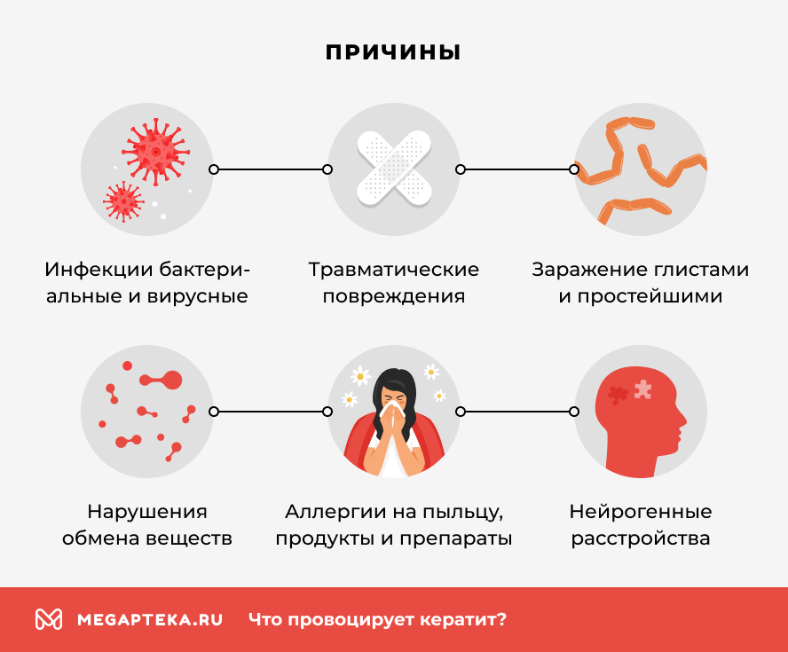 Причины
