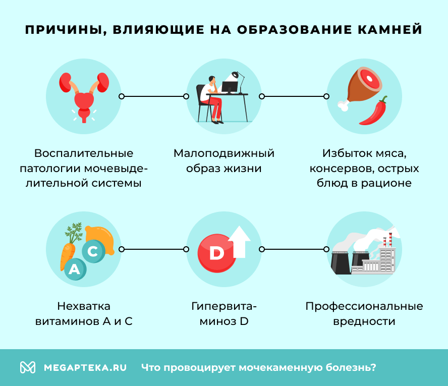 Причины, влияющие на образование камней