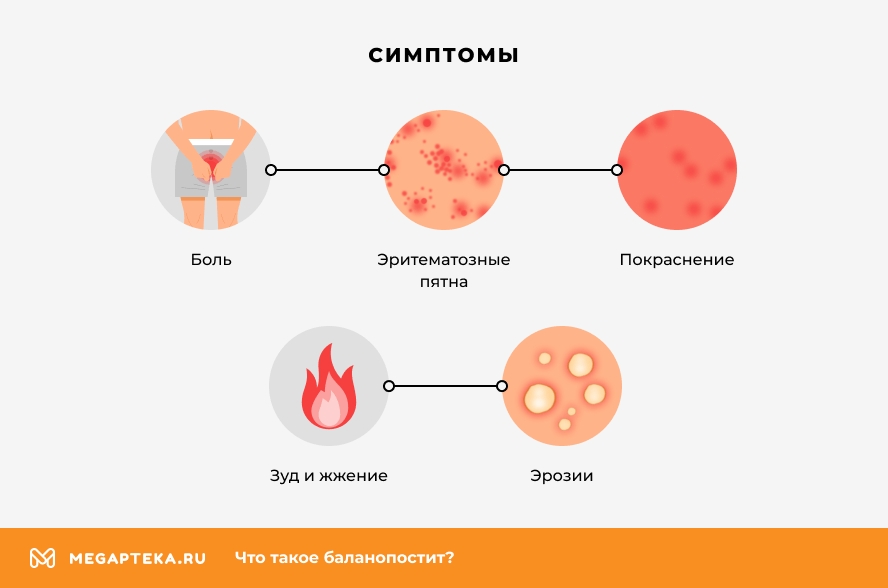 Баланопостит – виды и причины заболевания, симптомы, диагностика и лечение в Москве