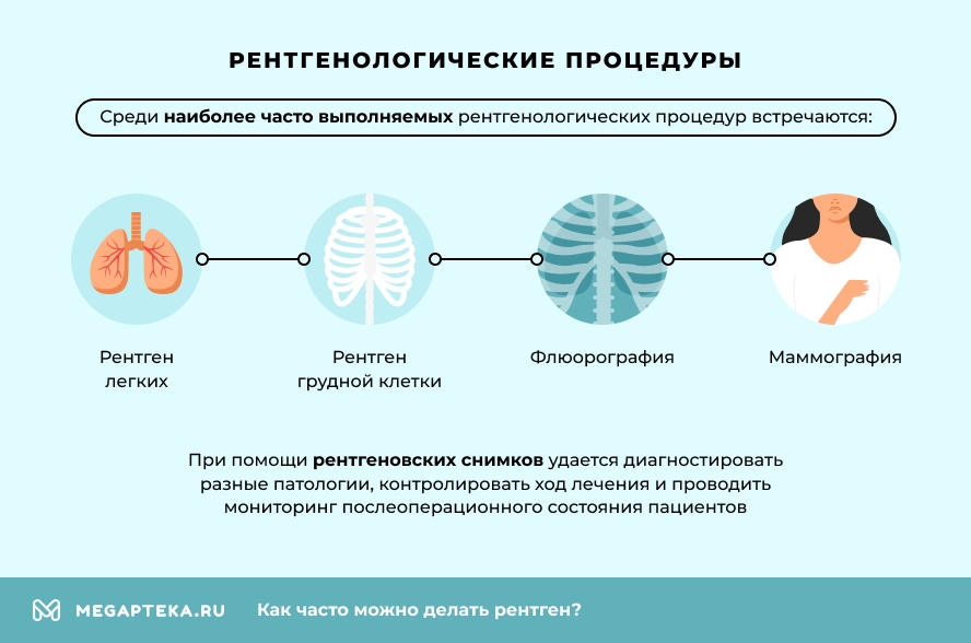 Рентгенологические процедуры