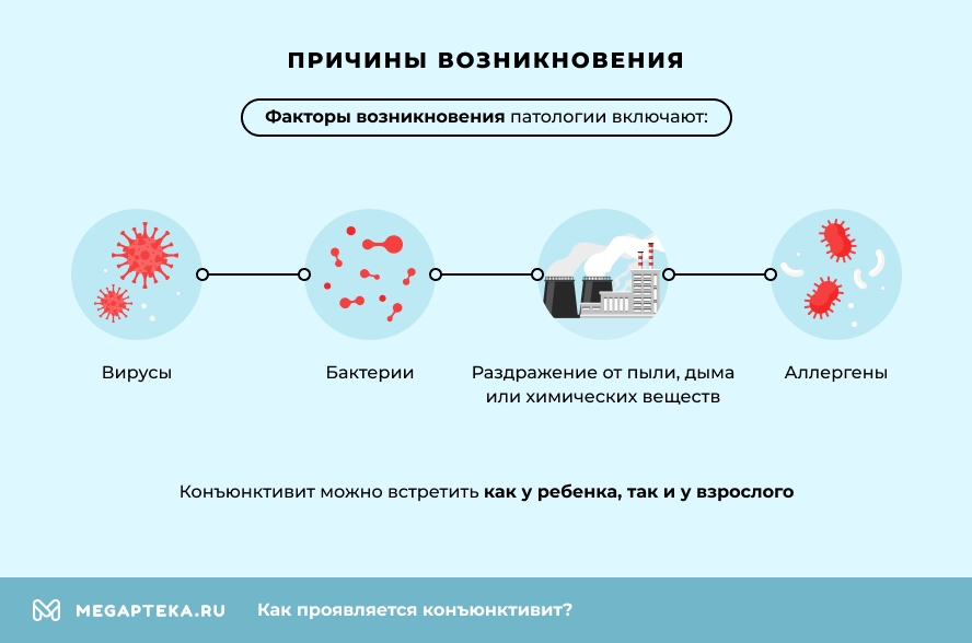 Конъюнктивит: клинические рекомендации