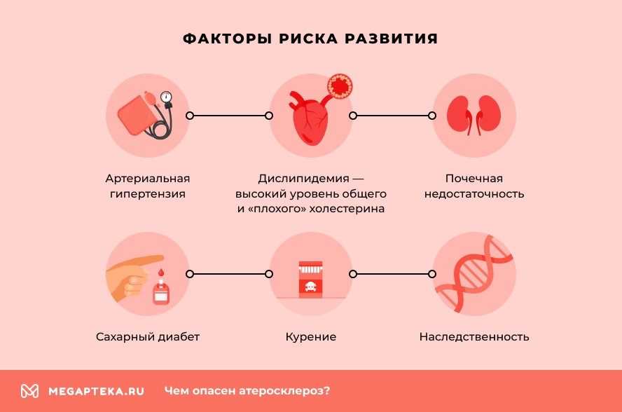 Атеросклероз: симптомы, диагностика и методы лечения заболевания