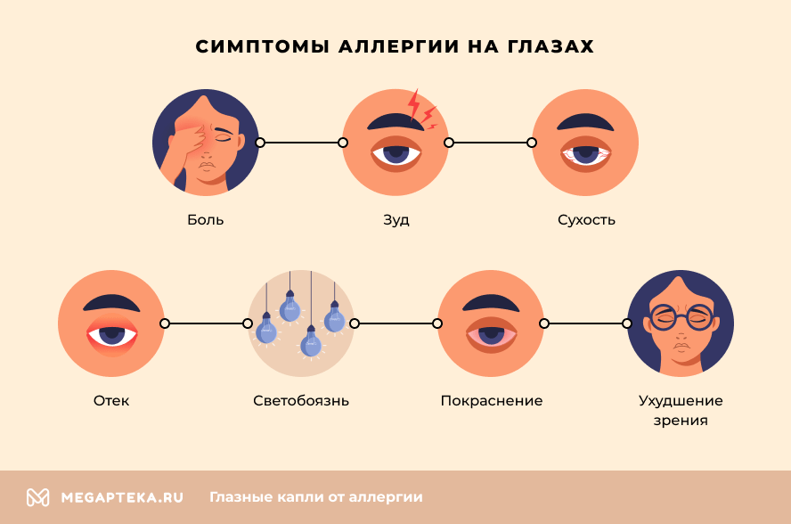 Симптомы аллергии на глазах