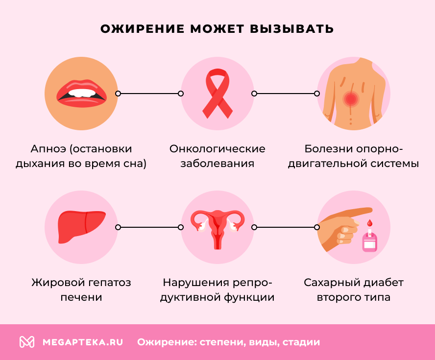 Ожирение может вызывать