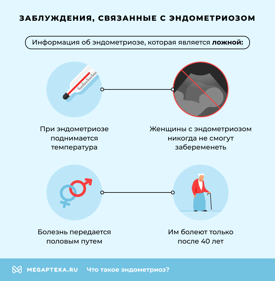 Заблуждения, связанные с эндометриозом