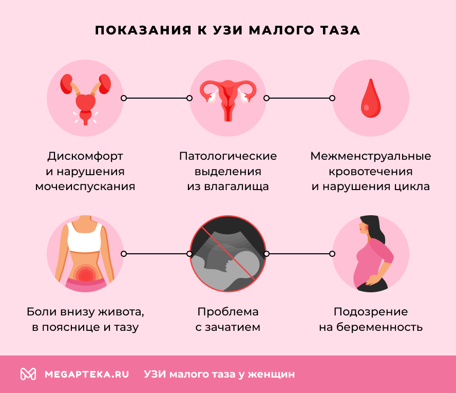 Показания к УЗИ малого таза
