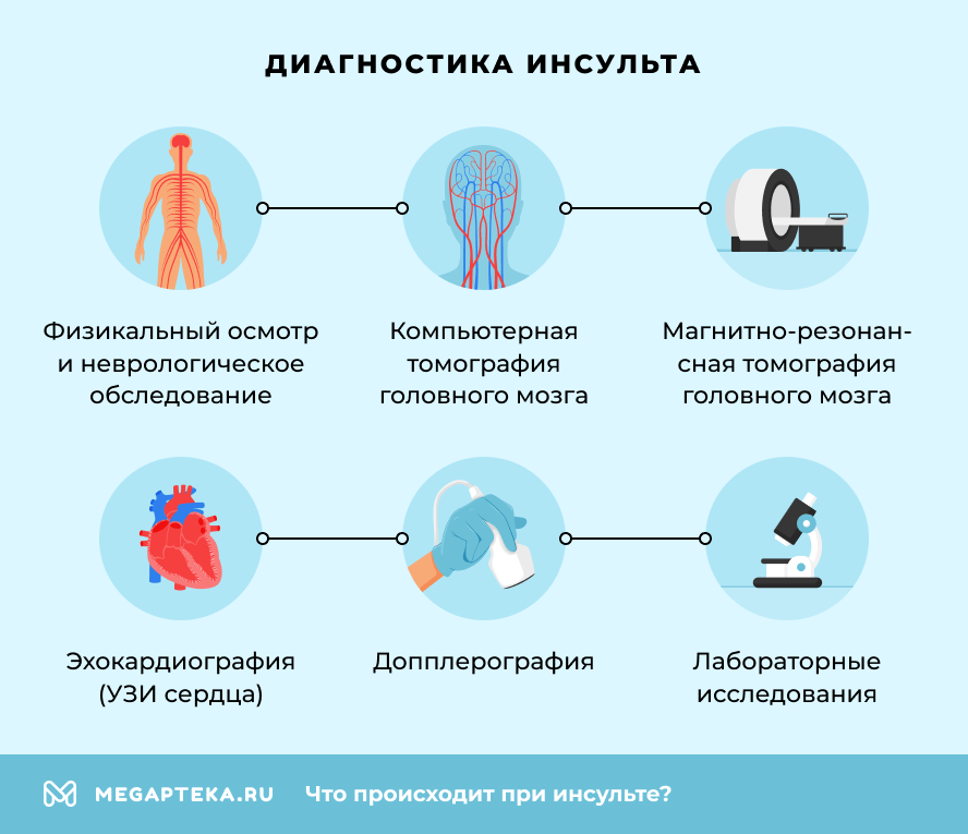 Диагностика инсульта