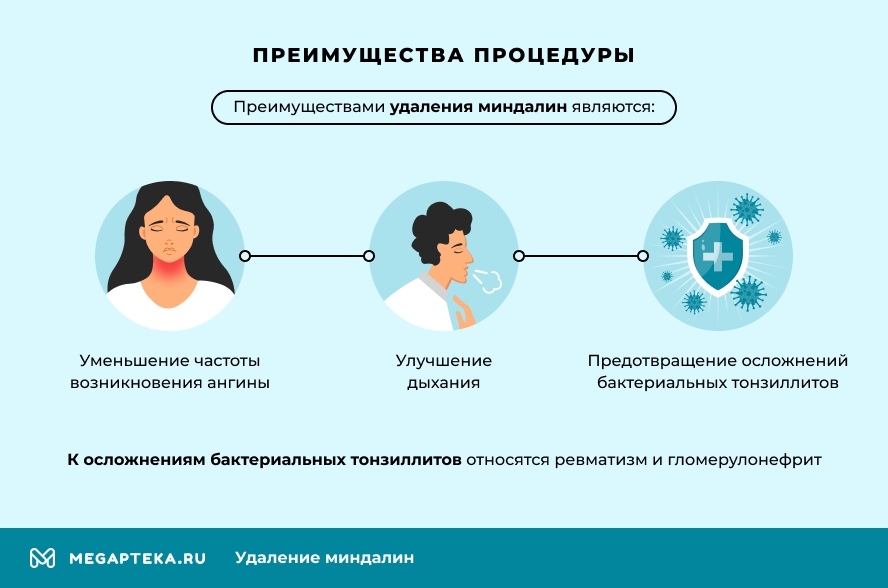 Преимущества процедуры