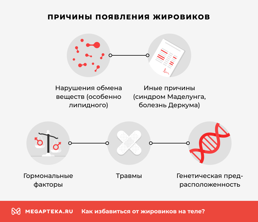 Причины появления жировиков