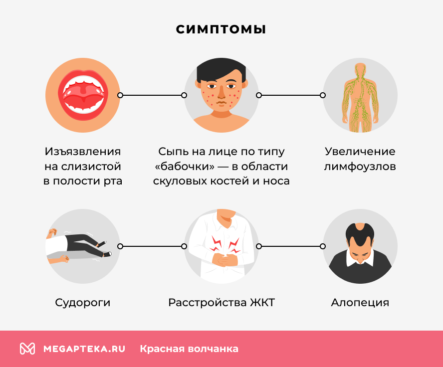 Симптомы