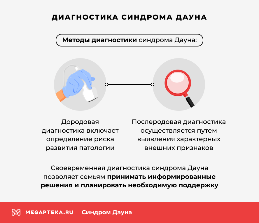 Диагностика синдрома Дауна