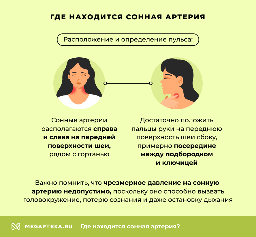 Где находится сонная артерия