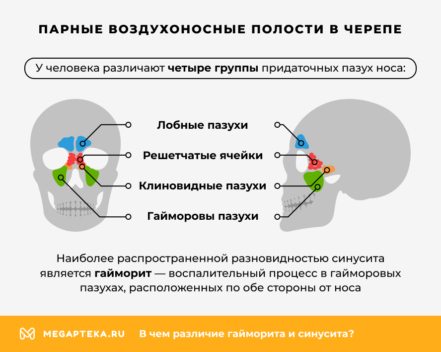 Парные воздухоносные полости в черепе