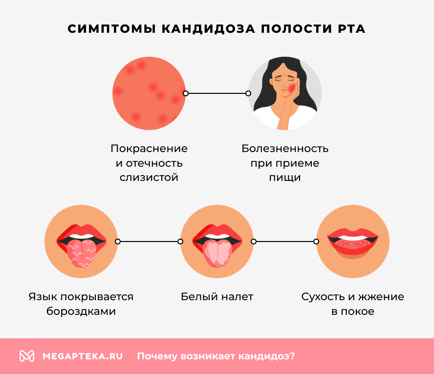 Симптомы