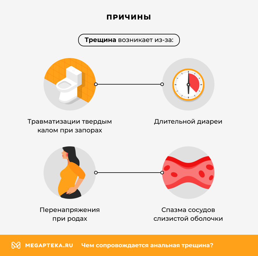 Причины