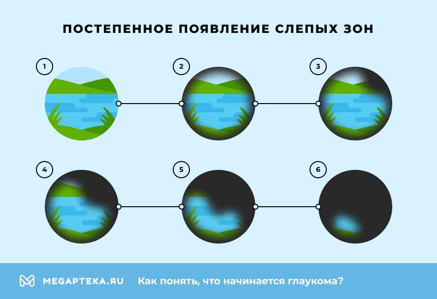Постепенное появление слупых зон