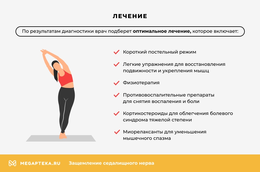 Защемление седалищного нерва: Симптомы и лечение, упражнения
