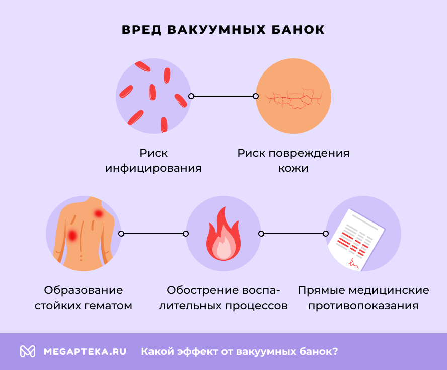 Вред вакуумных банок