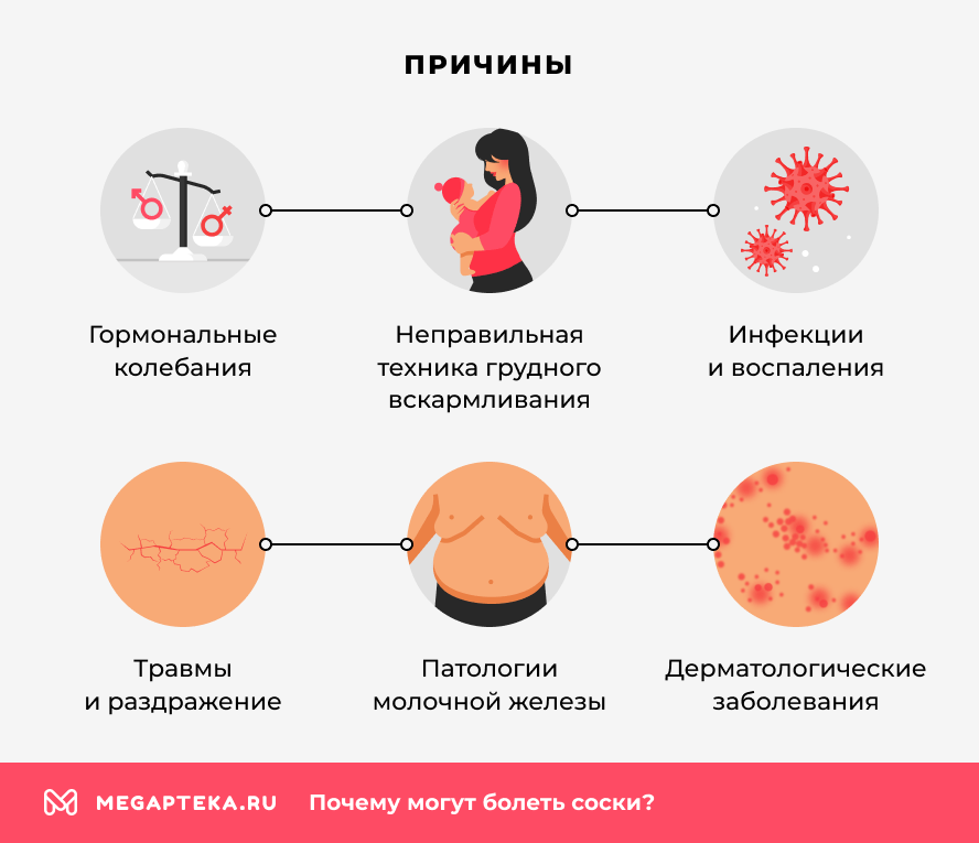 Причины