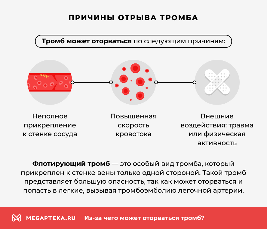 Причины отрыва тромба