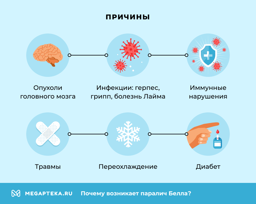 Причины