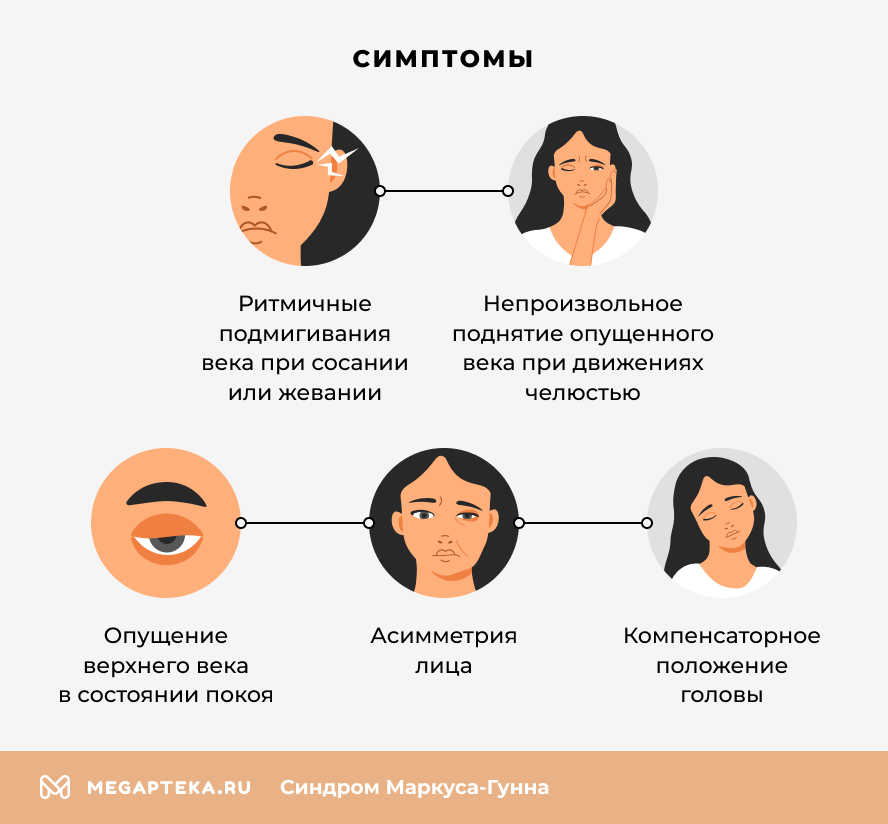 Симптомы