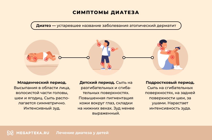 Причины и признаки акне новорожденного
