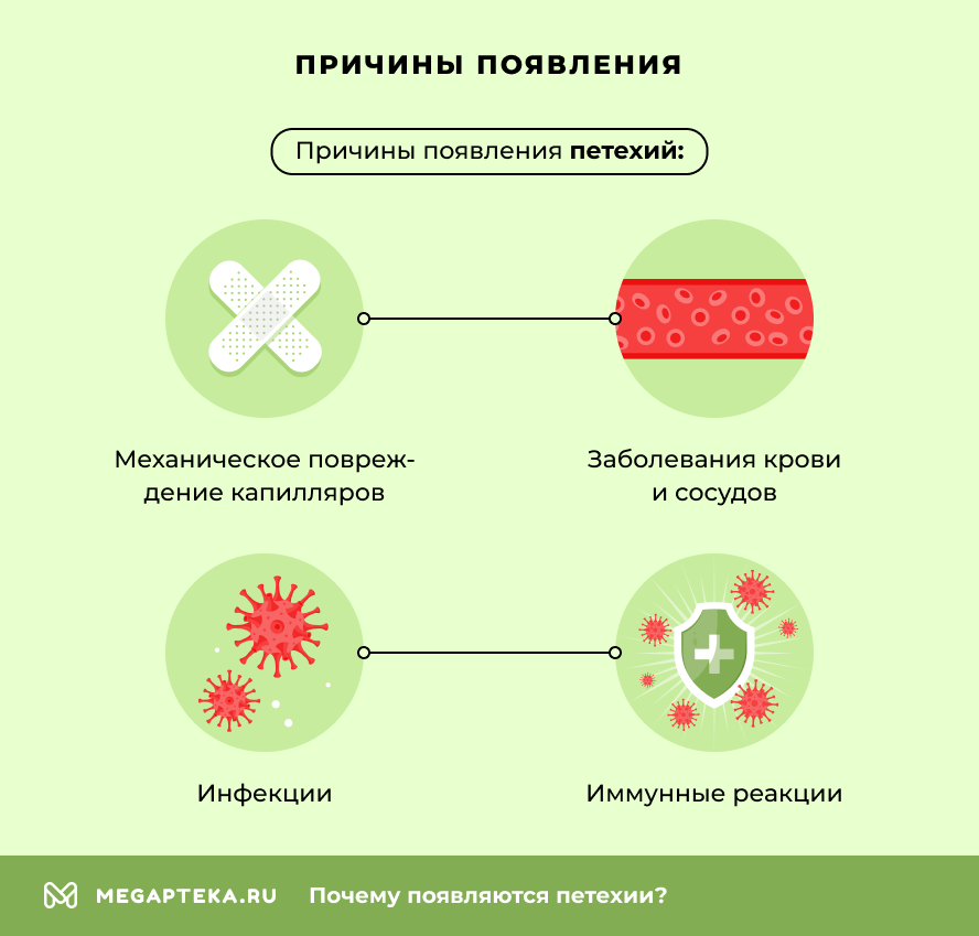 Причины появления