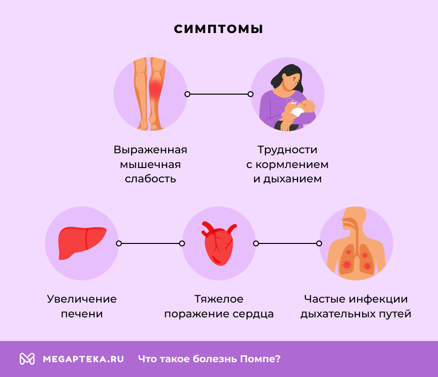 Симптомы