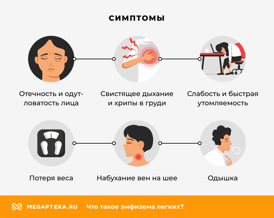 Симптомы