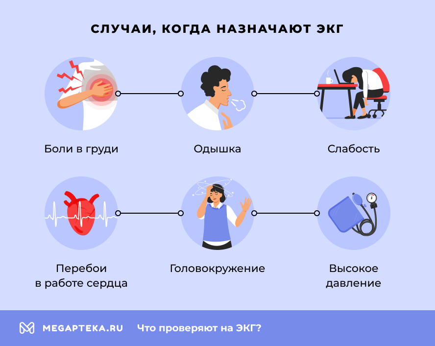 Случаи, когда назначают ЭКГ