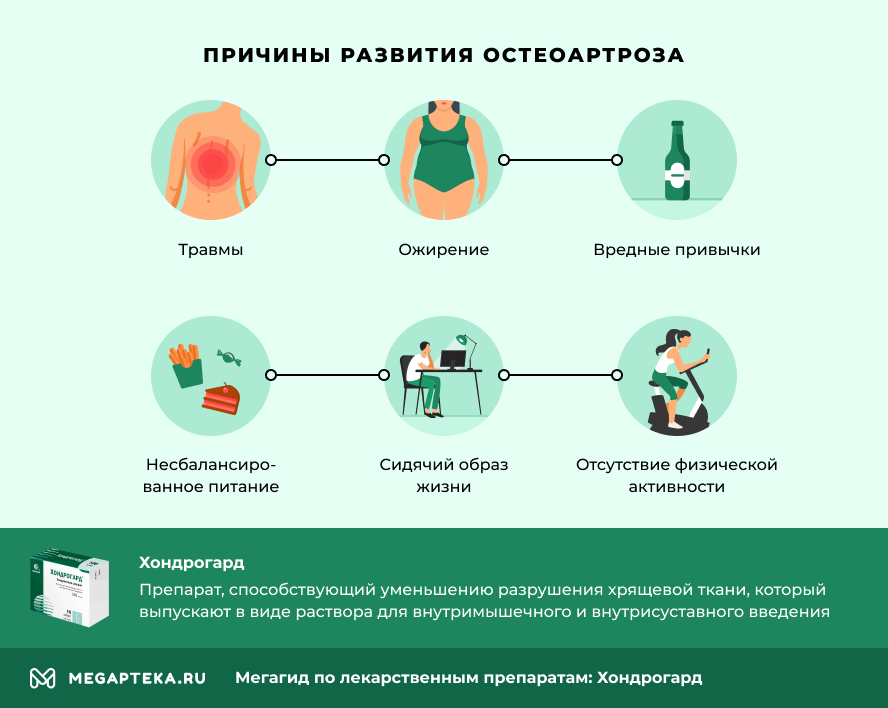 Причины развития остеоартроза