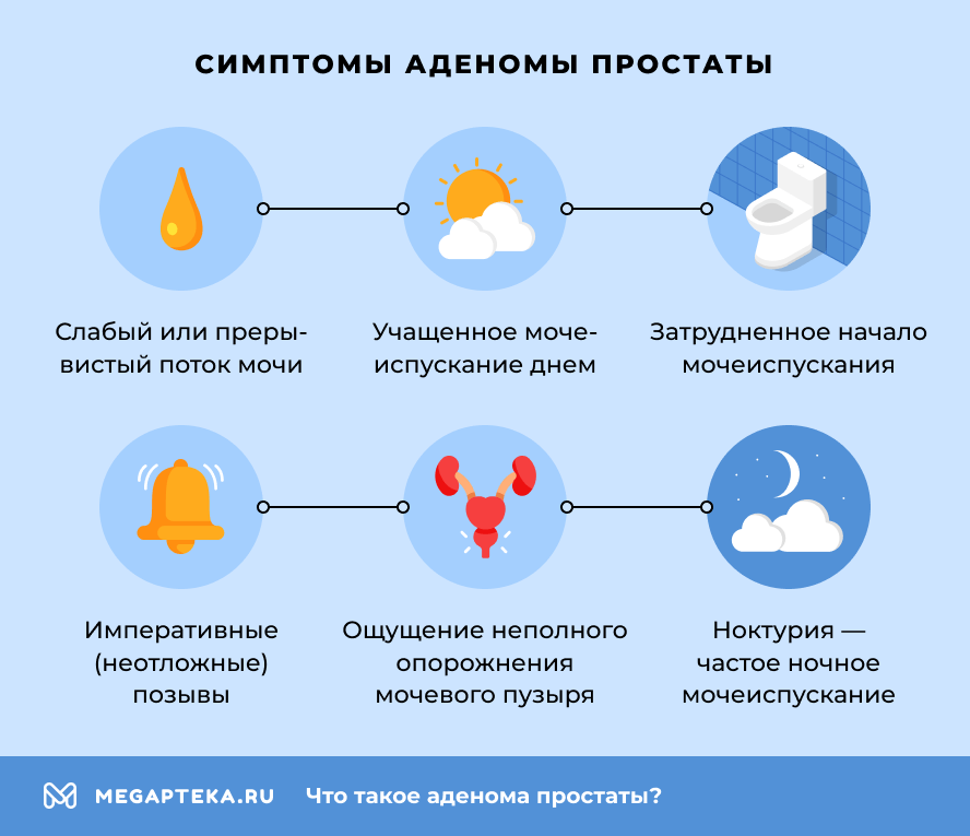 Симптомы аденомы простаты
