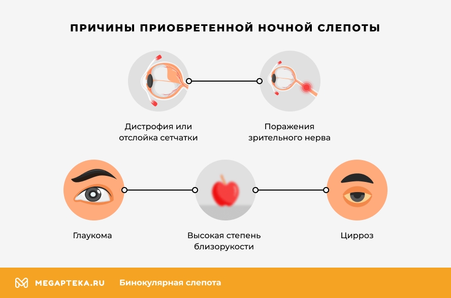 Причины приобретенной ночной слепоты