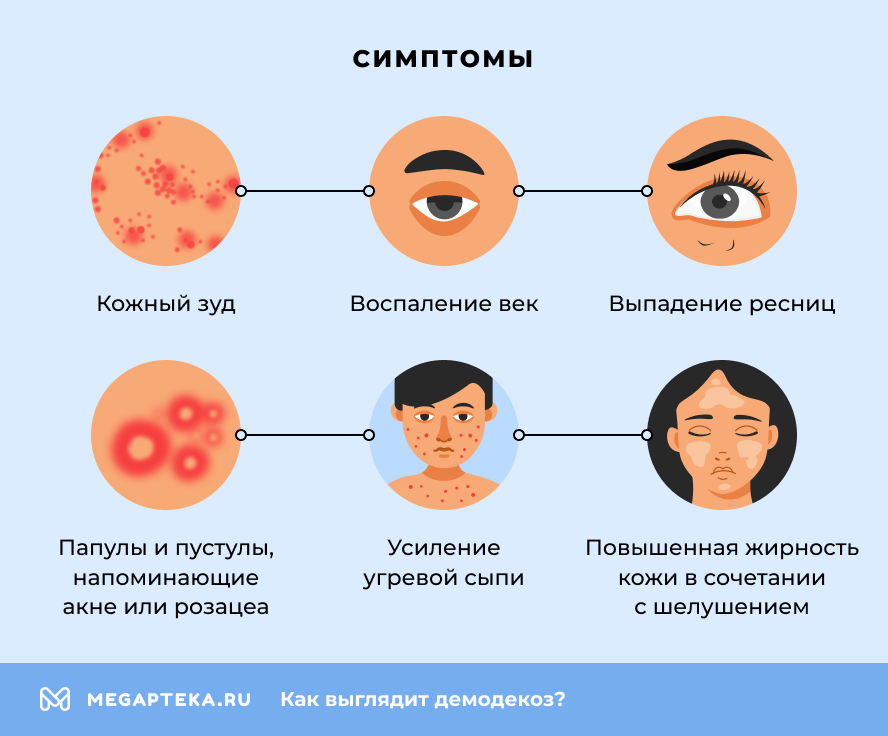 Симптомы