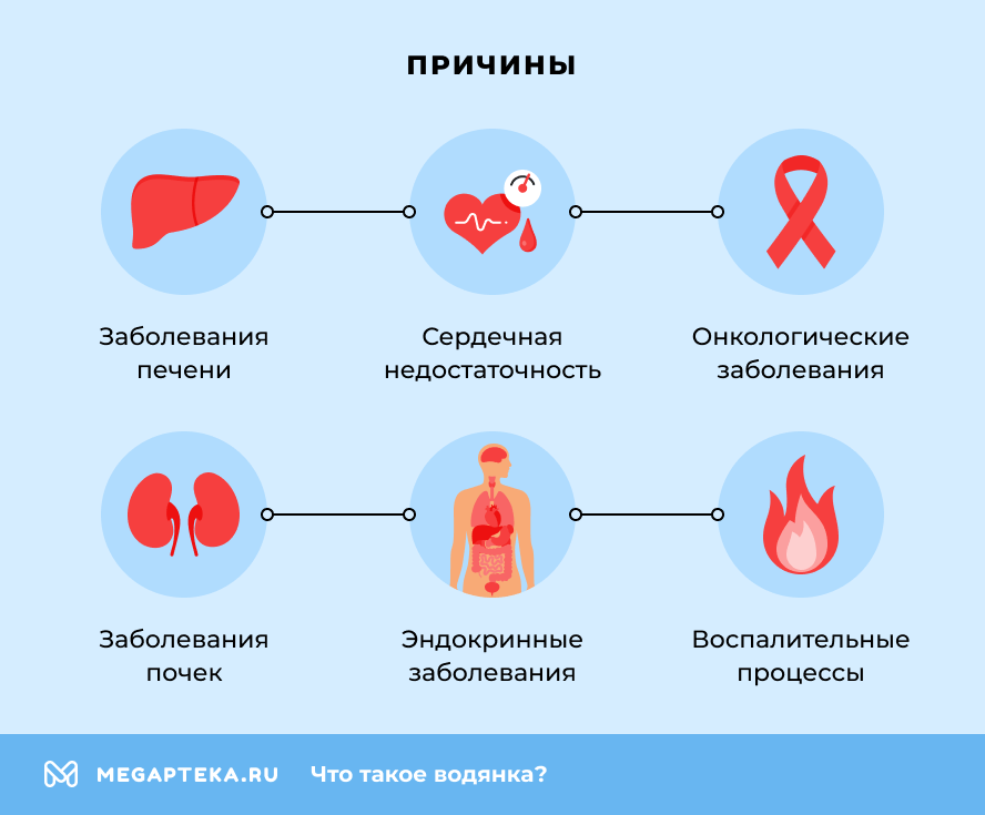 Причины