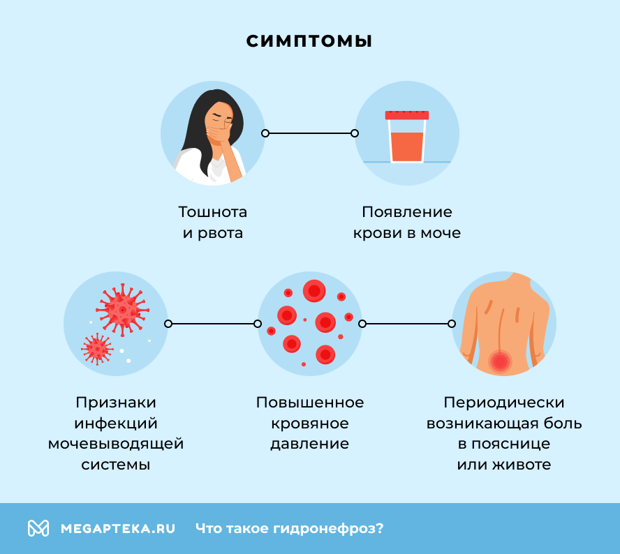 Симптомы