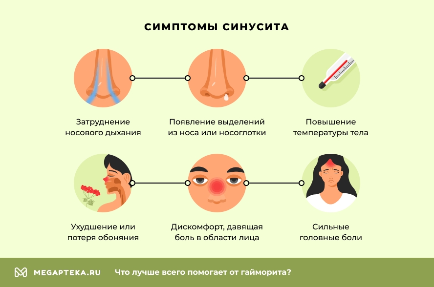 Симптомы синусита