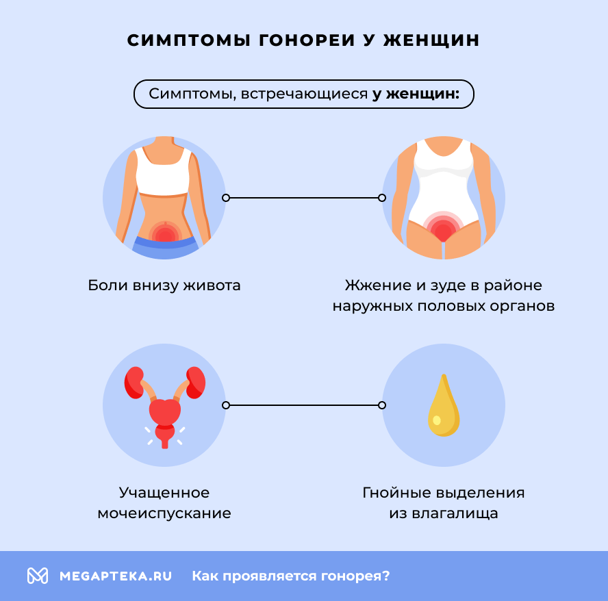 Симптомы гонореи у женщин