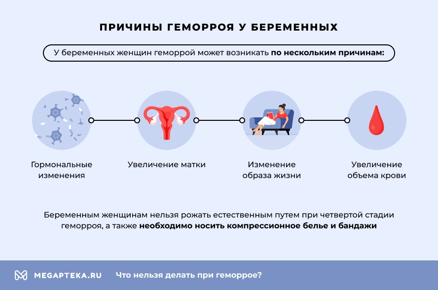 Причины геморроя у беременных
