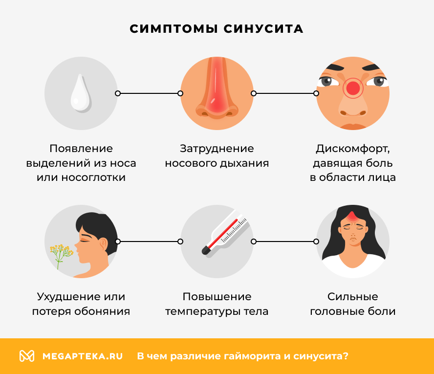 Симптомы синусита