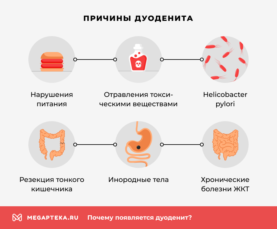 Причины дуоденита