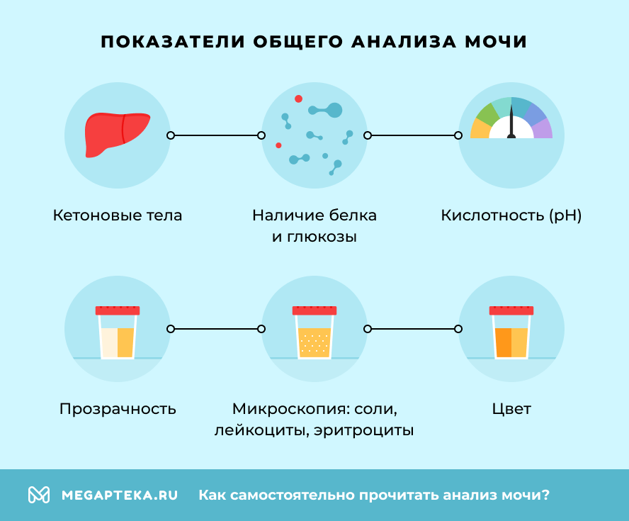 Показатели общего анализа мочи