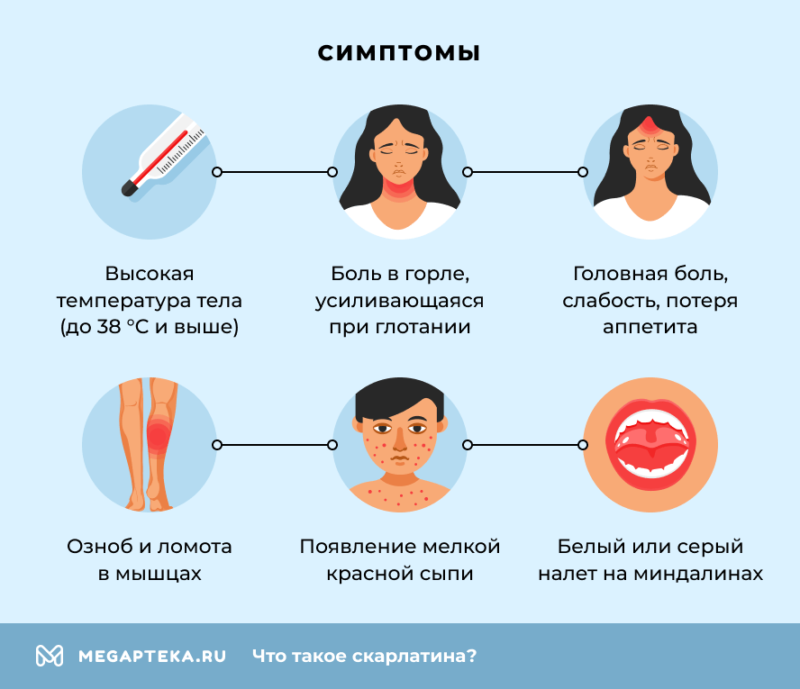 Симптомы скарлатины