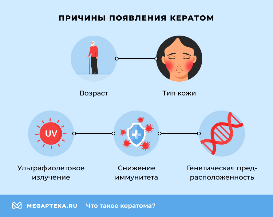 Причины появления кератом