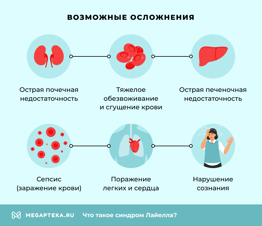 Возможные осложнения